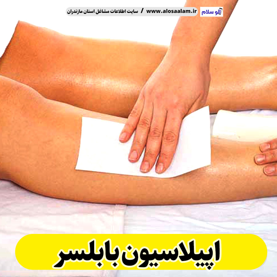 اپیلاسیون بابلسر، مرکز اپیلاسیون بابلسر، سالن اپیلاسیون بابلسر، اپیلاسیون کار بابلسر، قیمت اپیلاسیون بابلسر، اپیلاسیون زنان بابلسر، اپیلاسیون مردان بابلسر، الو سلام بابلسر، الو سلام مشاغل، سایت مشاغل بابلسر، سایت مشاغل مازندران