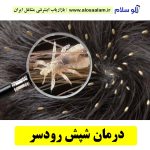 درمان شپش رودسر، درمان قطعی شپش سر رودسر، مرکز درمان شپش رودسر