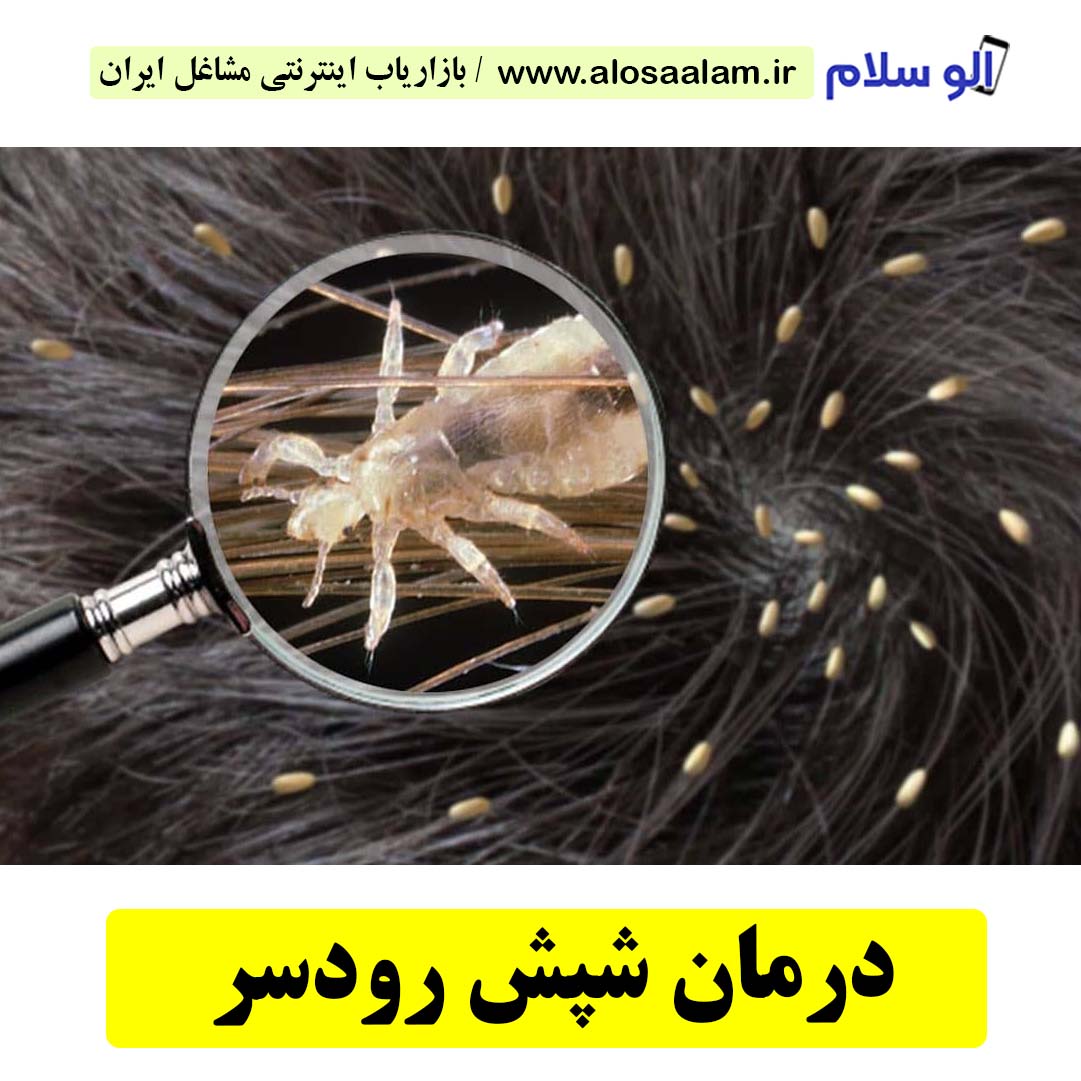 درمان شپش رودسر، درمان قطعی شپش سر رودسر، مرکز درمان شپش رودسر